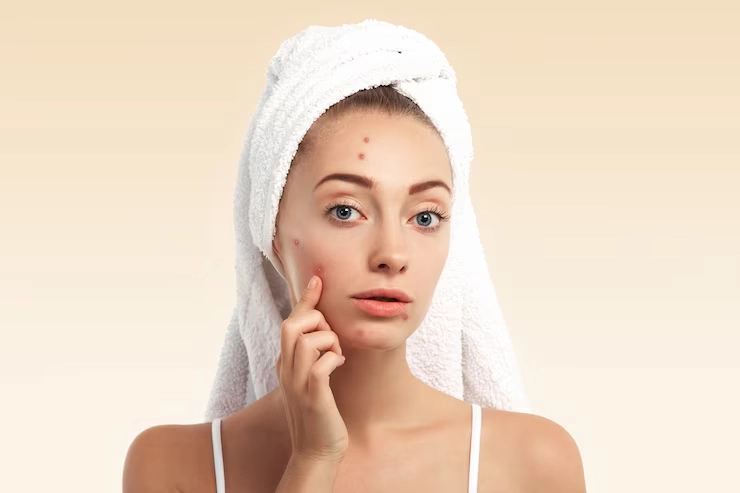 How Our Hyperpigmentation Solutions Will Solve Your Skin Issues