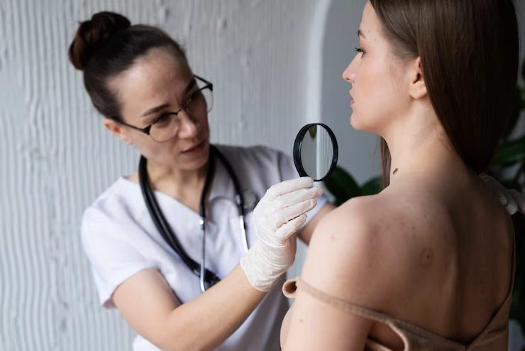Hyperpigmentation Solutions – Clinical Treatment Plans That Work